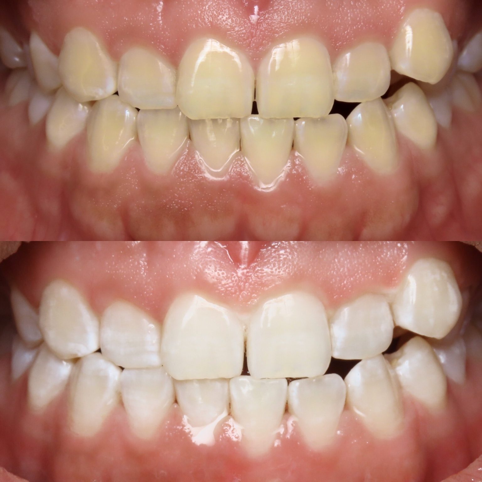 Gallery Dentist in Brownsville, TX